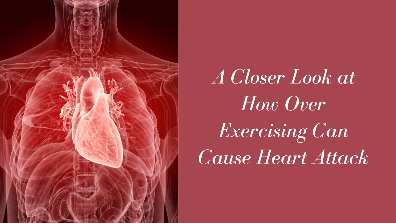 A Closer Look at How Over Exercising Can Cause Heart Attack